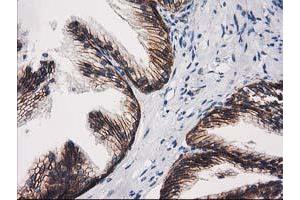 Image no. 2 for anti-Catenin (Cadherin-Associated Protein), beta 1, 88kDa (CTNNB1) antibody (ABIN1496893) (CTNNB1 抗体)