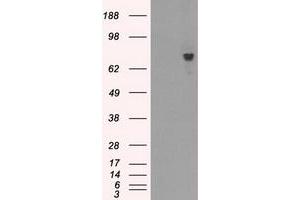 Image no. 5 for anti-Bruton Agammaglobulinemia tyrosine Kinase (BTK) antibody (ABIN1496976) (BTK 抗体)