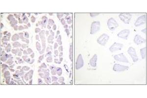 Immunohistochemistry analysis of paraffin-embedded human heart, using IKK-alpha/beta (Phospho-Ser180/181) Antibody. (IKK-alpha /IKK-beta 抗体  (pSer180))