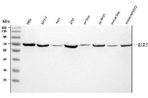 Western blot analysis of RARS/RARS1 using anti-RARS/RARS1 antibody (ABIN7600223). (Probable Arginine--tRNA Ligase, Cytoplasmic (RARS-1) (AA 165-425) 抗体)