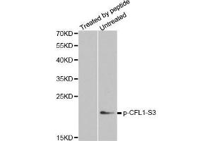 Western blot analysis of extracts from COLO205 cells, using phospho-CFL1-S3 antibody. (Cofilin 抗体  (pSer3))