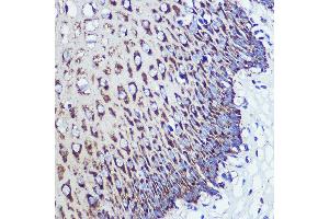 Immunohistochemistry of paraffin-embedded Human esophageal using OSBPL8 Rabbit pAb (ABIN7269139) at dilution of 1:100 (40x lens). (OSBPL8 抗体  (AA 1-110))