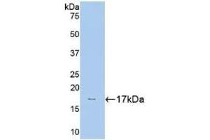 Detection of Recombinant HK1, Human using Polyclonal Antibody to Hexokinase 1 (HK1) (Hexokinase 1 抗体  (AA 80-215))