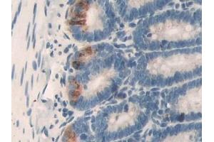 Detection of DLD in Rat Small intestine Tissue using Polyclonal Antibody to Dihydrolipoyl Dehydrogenase (DLD)