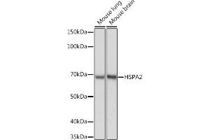 Western blot analysis of extracts of various cell lines, using HSP Rabbit mAb (ABIN7267579) at 1:1000 dilution. (HSPA2 抗体)