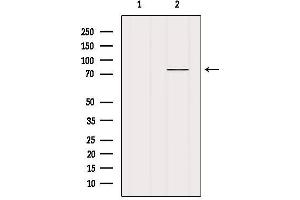 Western blot analysis of extracts from Mouse lung, using MECP2 Antibody. (MECP2 抗体  (C-Term))