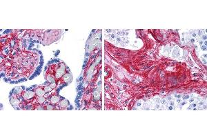 Immunohistochemistry of Rabbit anti-collagen VI antibody. (COL6 抗体  (HRP))
