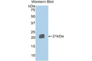 Western Blotting (WB) image for anti-Sema Domain, Immunoglobulin Domain (Ig), Transmembrane Domain (TM) and Short Cytoplasmic Domain, (Semaphorin) 4B (SEMA4B) (AA 192-367) antibody (ABIN1171799)