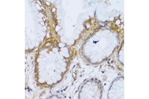 Immunohistochemistry of paraffin-embedded human stomach using GCC2 antibody (ABIN6130422, ABIN6141007, ABIN6141008 and ABIN6217941) at dilution of 1:150 (40x lens). (GCC2 抗体  (AA 1-300))