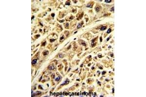 Immunohistochemistry (IHC) image for anti-Proline Arginine Rich End Leucine Rich Repeat Protein (PRELP) antibody (ABIN3002740) (PRELP 抗体)