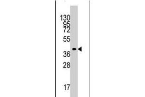 Western blot analysis of TBRG1 polyclonal antibody  in mouse kidney tissue lysates (35 ug/lane). (TBRG1 抗体  (N-Term))