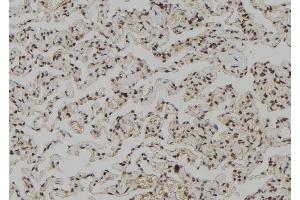 ABIN6267147 at 1/100 staining Human lung tissue by IHC-P. (NUMA1 抗体  (pSer395))