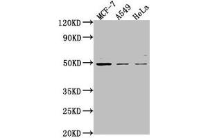 Western Blot Positive WB detected in: MCF-7 whole cell lysate, A549 whole cell lysate, Hela whole cell lysate All lanes: TSKU antibody at 1:2000 Secondary Goat polyclonal to rabbit IgG at 1/50000 dilution Predicted band size: 38 kDa Observed band size: 49 kDa