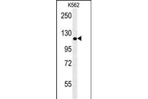 POTEE Antibody (Center) (ABIN653968 and ABIN2843918) western blot analysis in K562 cell line lysates (35 μg/lane). (POTEE 抗体  (AA 380-409))
