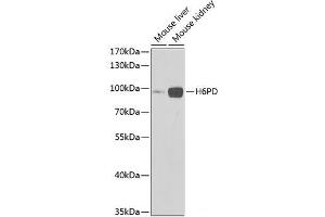 Western blot analysis of extracts of various cell lines using H6PD Polyclonal Antibody at dilution of 1:1000. (Glucose-6-Phosphate Dehydrogenase 抗体)