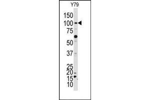 Image no. 1 for anti-NIMA related kinase 4 (NEK4) (C-Term) antibody (ABIN360540) (NEK4 抗体  (C-Term))