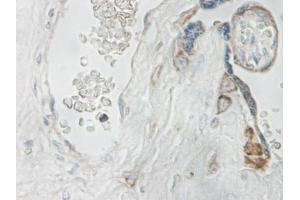 Image no. 1 for anti-Interleukin 15 (IL15) antibody (ABIN464930)