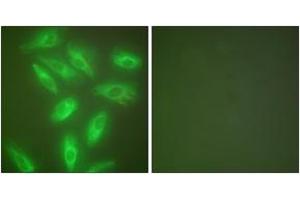 Immunofluorescence analysis of HeLa cells, using Keratin 18 Antibody. (Cytokeratin 18 抗体  (AA 381-430))