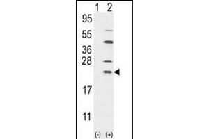 Western blot analysis of UBE2C (arrow) using rabbit polyclonal UBE2C Antibody (N-term G25) (ABIN388856 and ABIN2839158). (UBE2C 抗体  (N-Term))