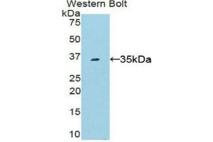 Western Blotting (WB) image for anti-Signal Transducer and Activator of Transcription 6, Interleukin-4 Induced (STAT6) (AA 557-841) antibody (ABIN3206147) (STAT6 抗体  (AA 557-841))