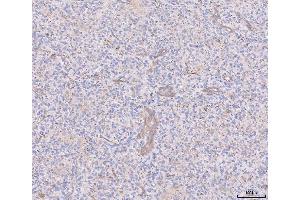 IHC analysis of ANGPT2 using anti-ANGPT2 antibody (ABIN3043725). (Angiopoietin 2 抗体  (AA 19-348))