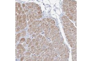 Immunohistochemical staining of human heart muscle with FAM184A polyclonal antibody  shows moderate cytoplasmic positivity in myocytes at 1:200-1:500 dilution. (FAM184A 抗体)