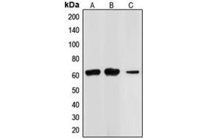 Western blot analysis of CHK2 expression in Jurkat (A), HL60 (B), HT29 (C) whole cell lysates. (CHEK2 抗体  (N-Term))