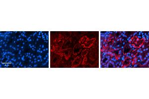 Rabbit Anti-AQP2 Antibody   Formalin Fixed Paraffin Embedded Tissue: Human Kidney Tissue Observed Staining: Cytoplasm Primary Antibody Concentration: 1:100 Other Working Concentrations: 1:600 Secondary Antibody: Donkey anti-Rabbit-Cy3 Secondary Antibody Concentration: 1:200 Magnification: 20X Exposure Time: 0. (AQP2 抗体  (Middle Region))