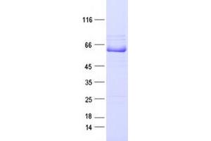 Western Blotting (WB) image for EPH Receptor A7 (EPHA7) protein (DYKDDDDK Tag) (ABIN2720243)