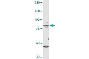 TRPV1 monoclonal antibody (M01), clone 1F5. (TRPV1 抗体  (AA 21-124))