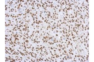 IHC-P Image Immunohistochemical analysis of paraffin-embedded C2C12 xenograft, using Lamin A + C, antibody at 1:500 dilution. (Lamin A/C 抗体)