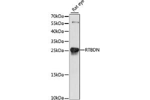 Western blot analysis of extracts of rat eye, using RTBDN antibody (ABIN6293760) at 1:1000 dilution. (Retbindin 抗体)