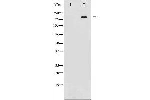 Western blot analysis of Ret phosphorylation expression in K562 whole cell lysates,The lane on the left is treated with the antigen-specific peptide. (Ret Proto-Oncogene 抗体  (pTyr1062))