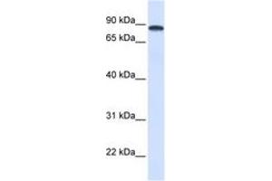Image no. 1 for anti-DEAD (Asp-Glu-Ala-Asp) Box Polypeptide 1 (DDX1) (AA 432-481) antibody (ABIN6742674) (DDX1 抗体  (AA 432-481))
