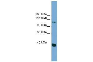 Catenin antibody used at 1 ug/ml to detect target protein. (Catenin 抗体)