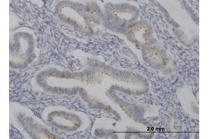 Immunoperoxidase of monoclonal antibody to SPP1 on formalin-fixed paraffin-embedded human endometrium. (Osteopontin 抗体  (AA 148-257))