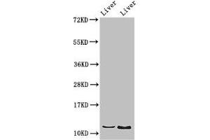 Western Blot Positive WB detected in: Rat liver tissue, Mouse liver tissue All lanes: DDA1 antibody at 2.