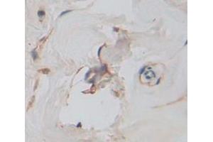 IHC-P analysis of Human Tissue, with DAB staining. (KIR2DL1 抗体  (AA 22-348))
