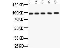 Anti- NUP98 Picoband antibody, Western blotting All lanes: Anti NUP98  at 0. (NUP98 抗体  (AA 549-880))