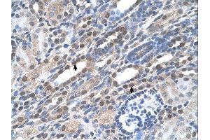 Sample Type: Human KidneyDilution: 4. (NOLC1 抗体  (C-Term))