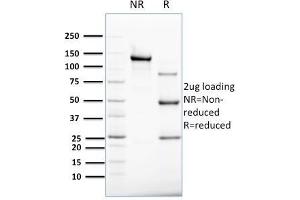 SDS-PAGE AnalysisPurified Cytokeratin 8 Mouse Monoclonal Antibody (B22.