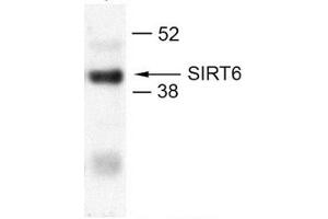 U2OS (SIRT6 抗体  (N-Term))