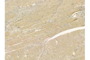 ABIN6265892 and ABIN6276955 at 1/100 staining human tongue carcinoma by IHC-P. (Uromodulin 抗体  (C-Term))