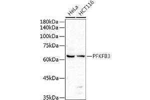 Western blot analysis of extracts of various cell lines, using PFKFB3 antibody (ABIN6129841, ABIN6145485, ABIN6145487 and ABIN6222692) at 1:500 dilution. (PFKFB3 抗体  (AA 400-500))