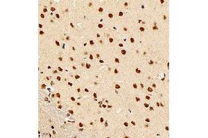 Immunohistochemistry of paraffin embedded rat brain using smad62024 (ABIN7075629) at dilution of 1:1500 (400x lens) (SMAD6 抗体)