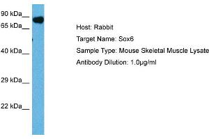 Host: Mouse Target Name: SOX6 Sample Tissue: Mouse Skeletal Muscle Antibody Dilution: 1ug/ml (SOX6 抗体  (Middle Region))