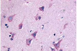 Anti-QRFPR / GPR103 antibody  ABIN1049284 IHC staining of human brain, neurons and glia. (QRFPR 抗体  (N-Term))