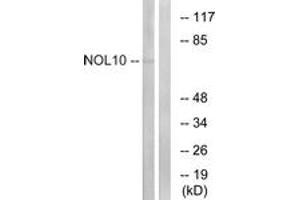 Western blot analysis of extracts from HuvEc cells, using NOL10 Antibody. (NOL10 抗体  (AA 639-688))