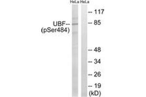 Western blot analysis of extracts from HeLa cells treated with calyculinA 50ng/ml 30', using UBF (Phospho-Ser484) Antibody. (UBTF 抗体  (pSer484))