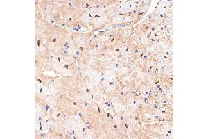 Immunohistochemistry of paraffin-embedded mouse heart using sestrin 1 Rabbit mAb (ABIN7270259) at dilution of 1:100 (40x lens). (SESN1 抗体)